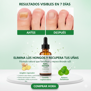 Spray Antihongos para Uñas 30ml